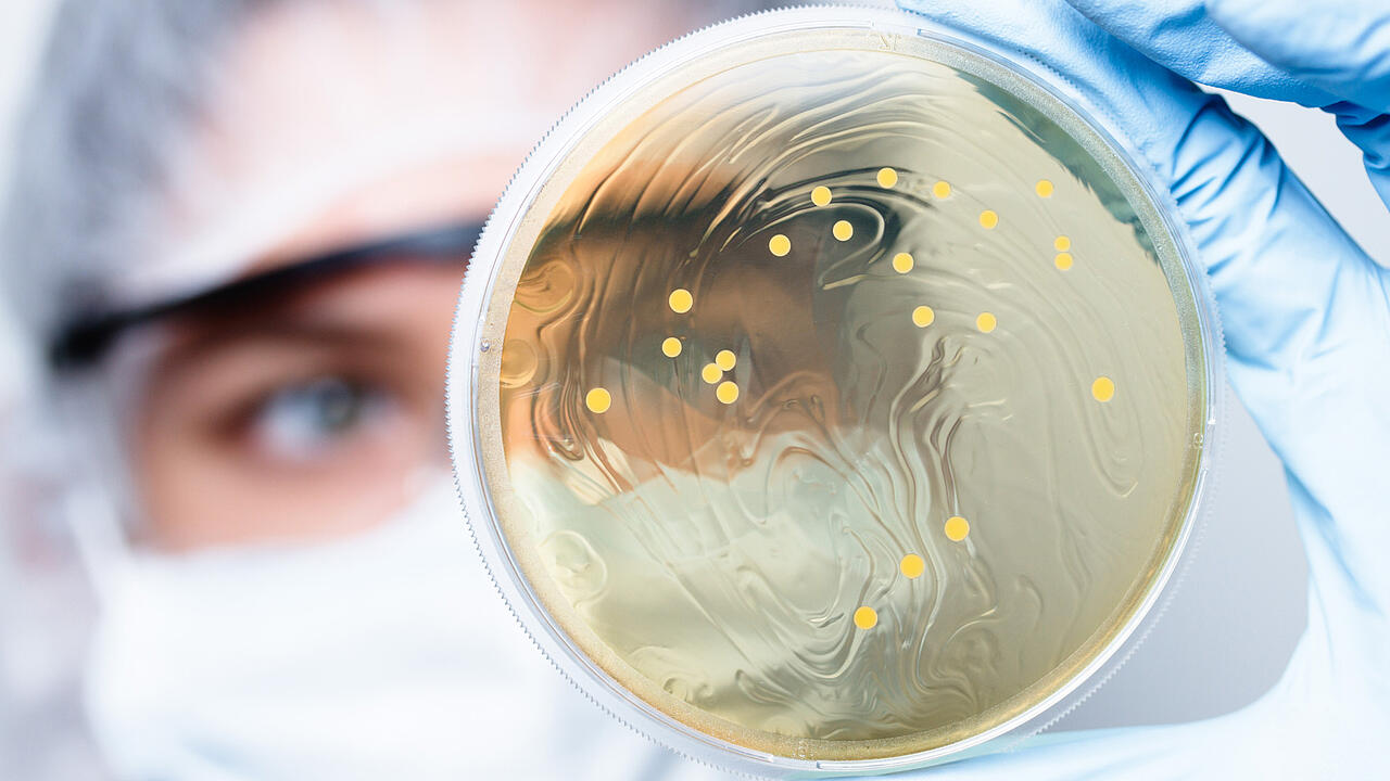 Científico al fondo con una placa de Petri con bacterias en la mano (en primer plano)